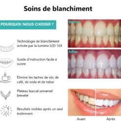 Appareil led pour blanchiment dentaire