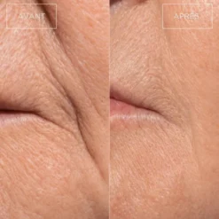 Masque led visage anti-âge re:gen i