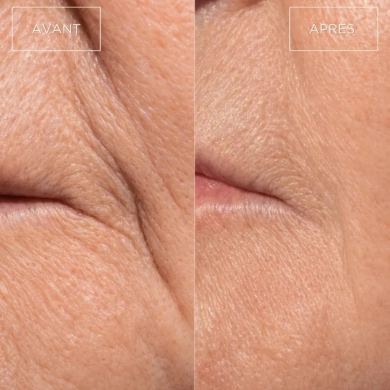 Masque led visage anti-âge re:gen i